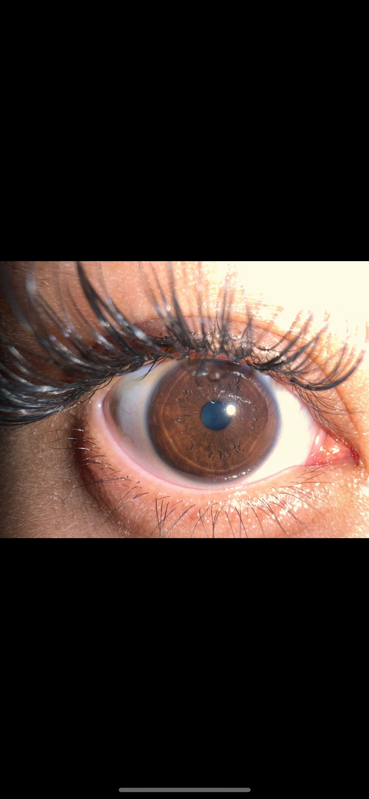 Iridology & Initial Consult: Eye Analysis for Whole Body Insight