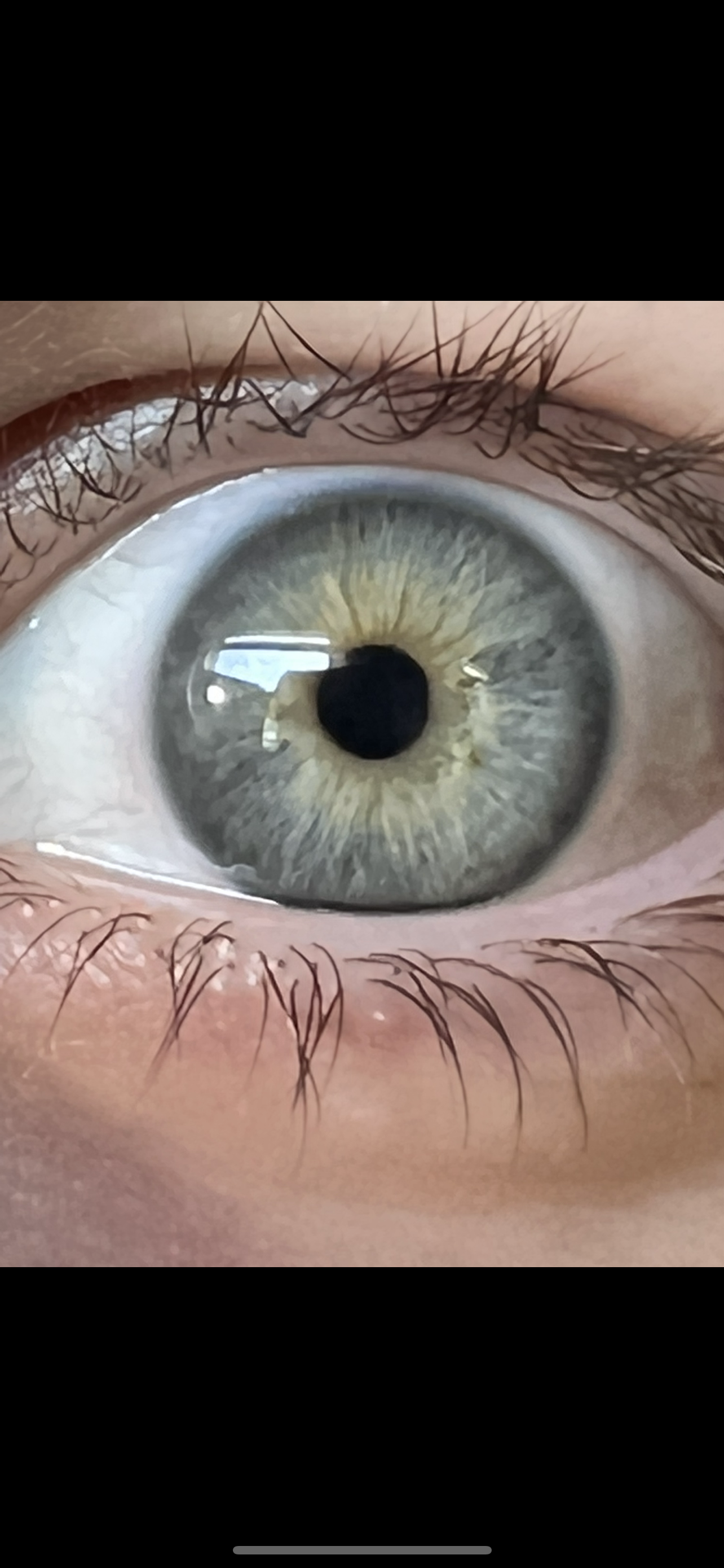 Iridology & Initial Consult: Eye Analysis for Whole Body Insight