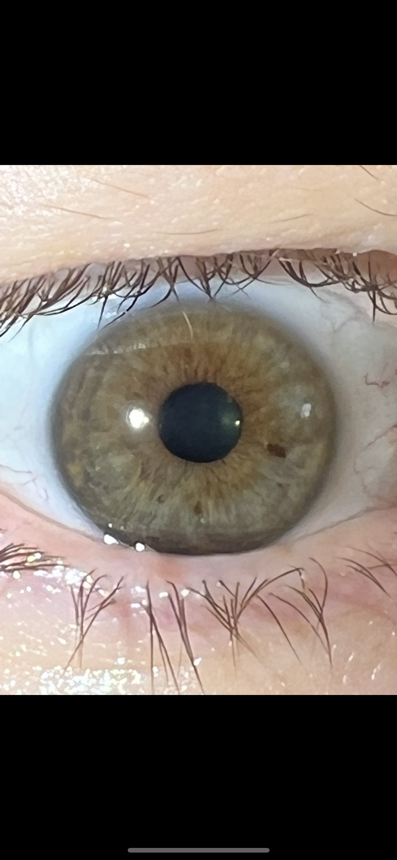 Iridology & Initial Consult: Eye Analysis for Whole Body Insight