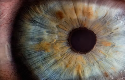 Blue & brown iris