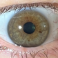 Iridology & Initial Consult: Eye Analysis for Whole Body Insight