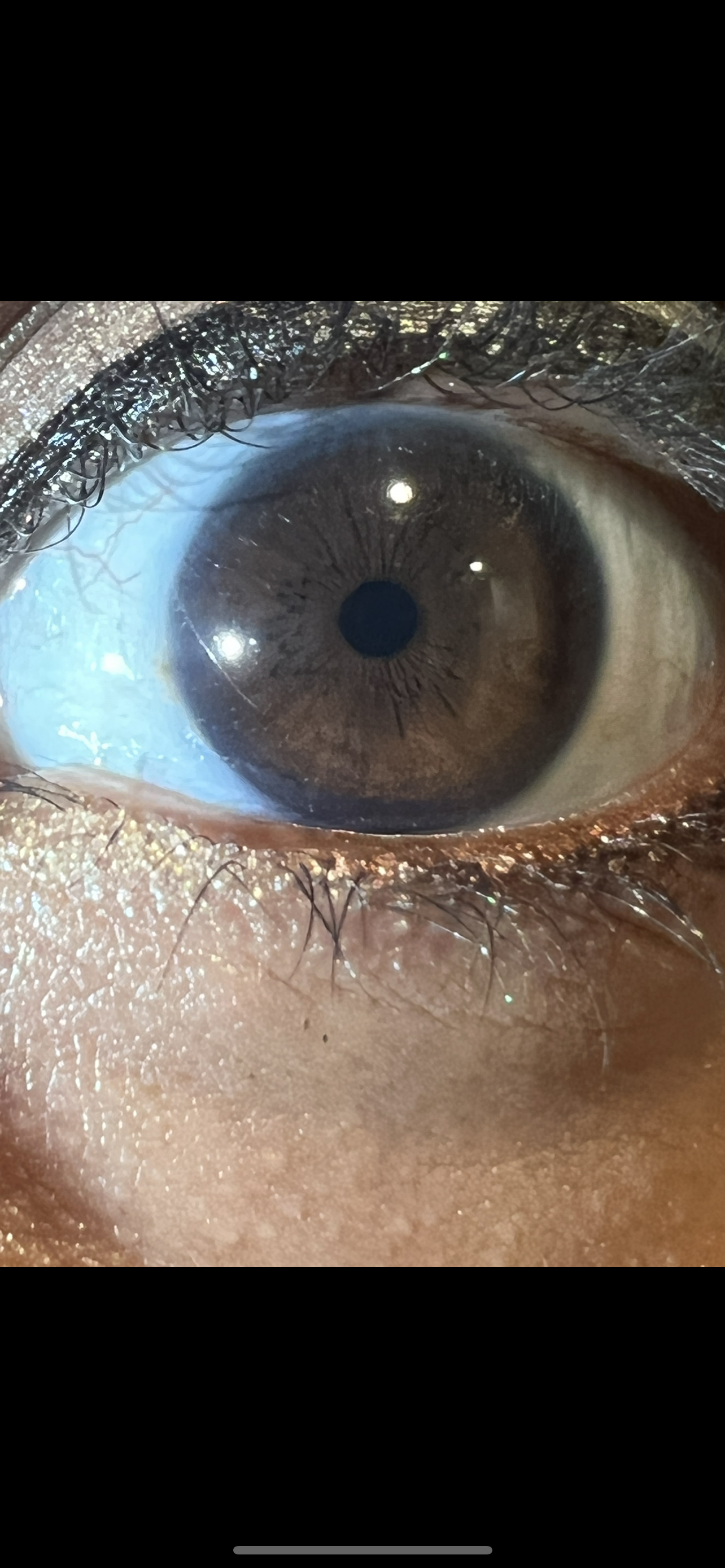 Iridology & Initial Consult: Eye Analysis for Whole Body Insight